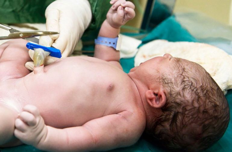 umbilical cord blood banking