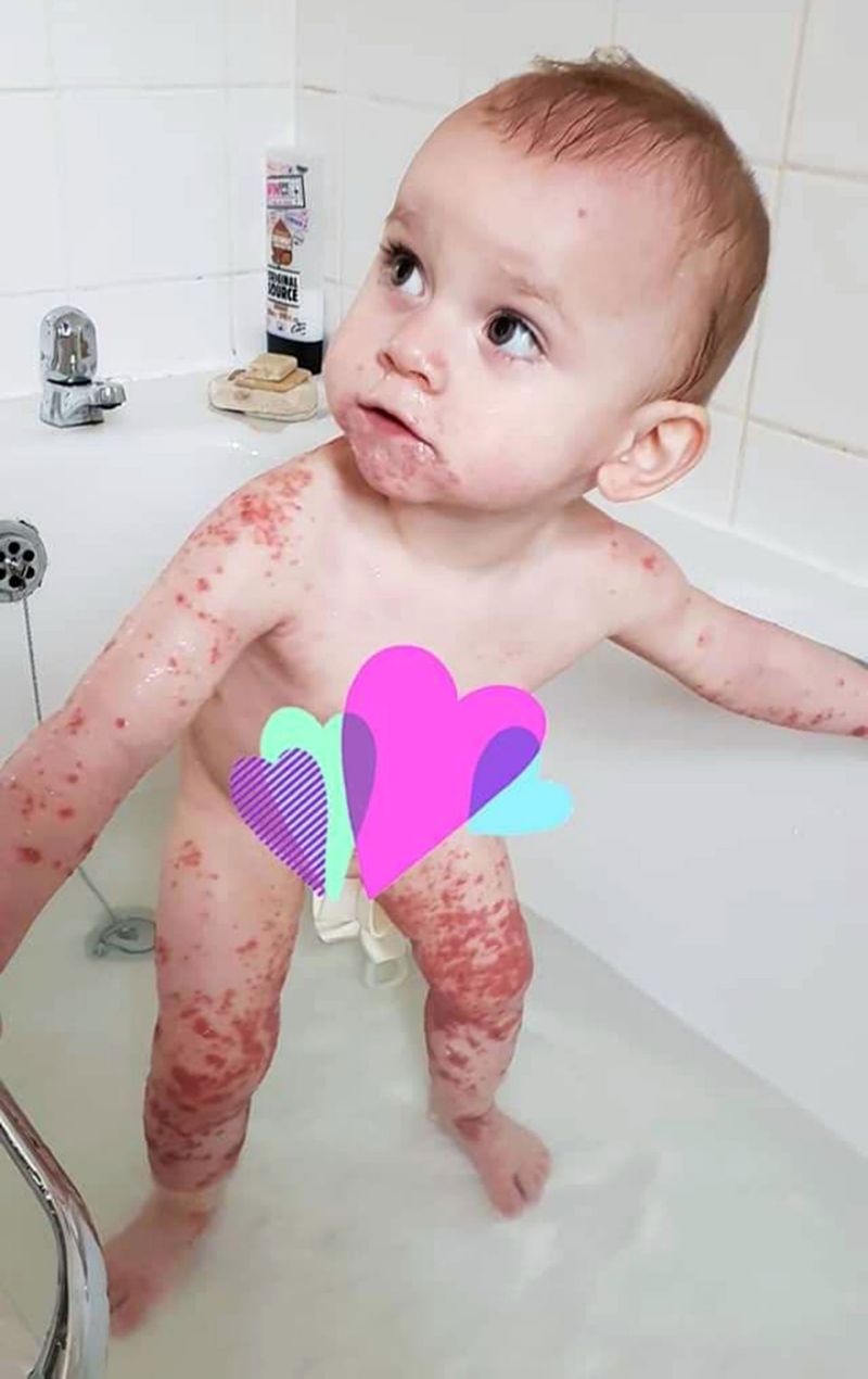 Baby Fever Cold Bath / Baby food during fever cough and cold - YouTube - Frida is the brand that gets parents.