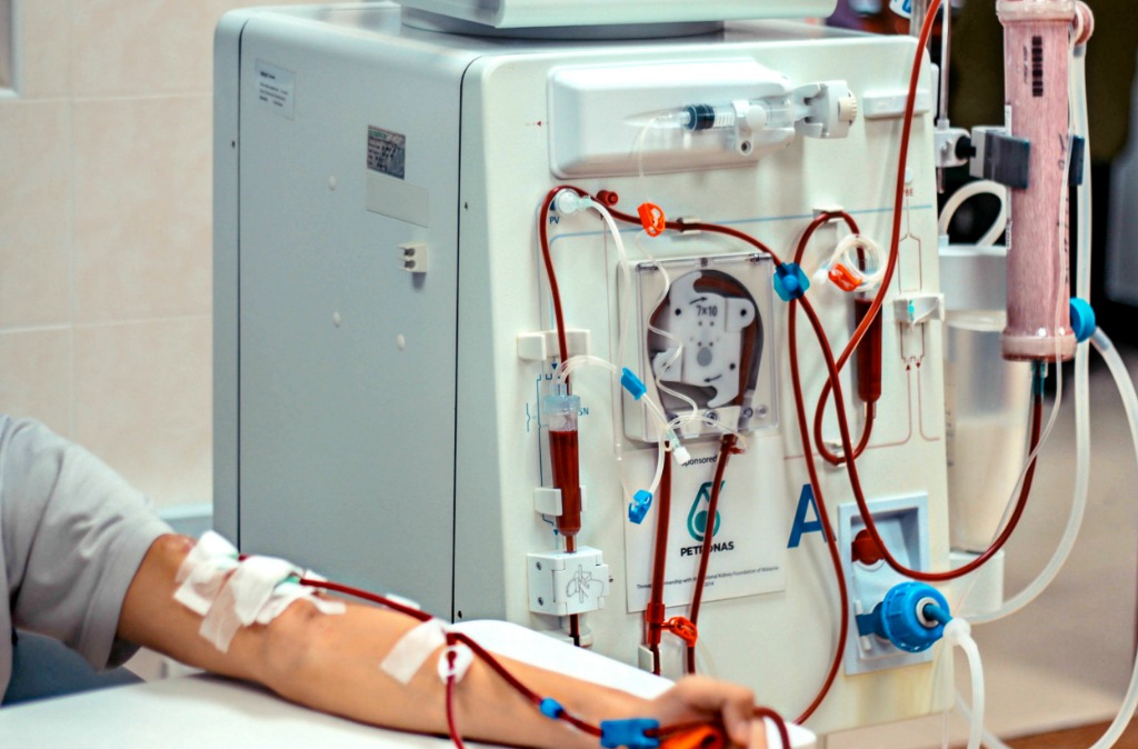 Что такое гемодиализ. Dialysis Machine. Низкопоточный гемодиализ. Экстракорпоральный гемодиализ.