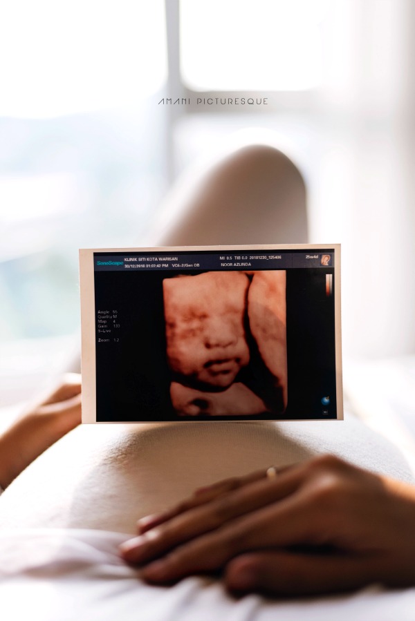 Fabulous 5D scan Ultrasound with all details in!