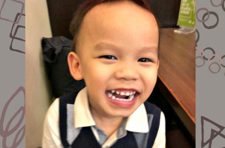 Ashton Wong shows off his set of pearly whites. (Image Credit: Rebecca Ng)