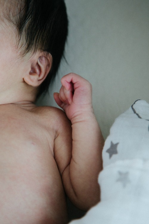Atopic eczema often affects the very young. For this reason, it is also called baby eczema or infantile eczema.