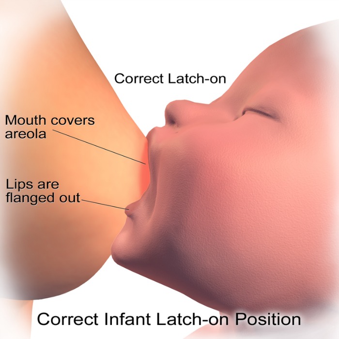 A good breastfeeding latch. The baby's chin is against the breast and the nose is slightly away from the breast. Almost all of the areola especially the lower portion is well within baby's mouth. Lips are flanged out. (Image Credit: By BruceBlaus ─ ‘Medical gallery of Blausen Medical 2014’, Wikimedia Commons) 