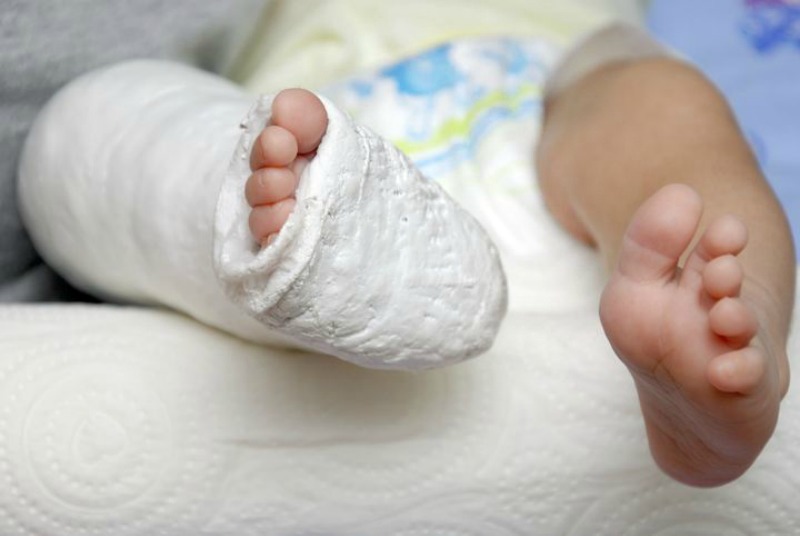 If your child has broken his leg or arm, splint the area with a blanket, thick cloth or pillow to avoid movement. Use a cloth sling for any broken bones of the upper limbs. Then take him to the hospital. (Image Credit: HuffPost)