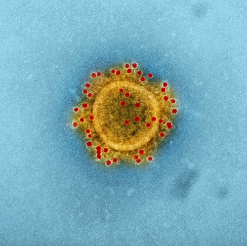 The virus wears a crown. That is why it is called corona (Image Credit: Unsplash/CDC) 