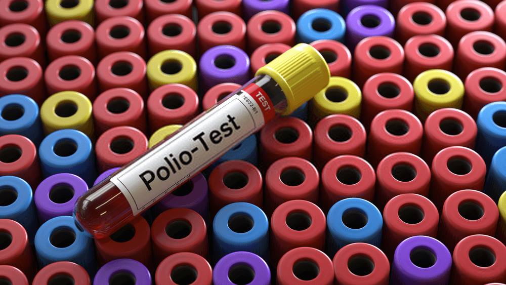 polio-test for poliovirus