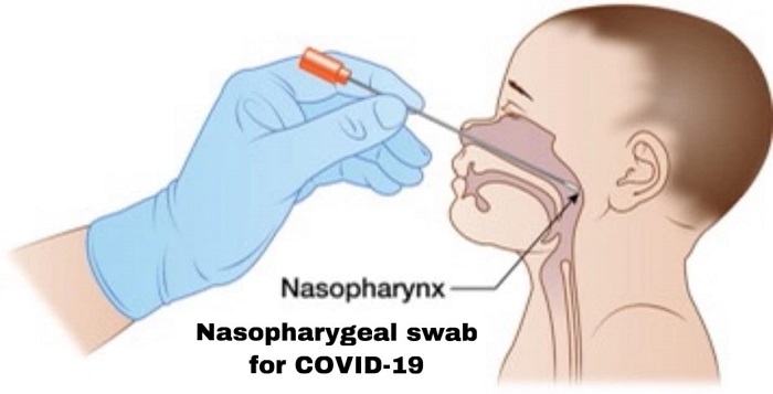 covid-19 nose swab if your child is sick