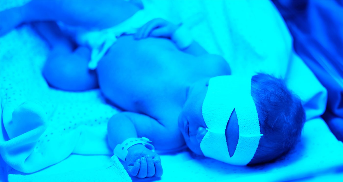 Breastfeeding Jaundice Is My Baby at Risk? Motherhood Malaysia