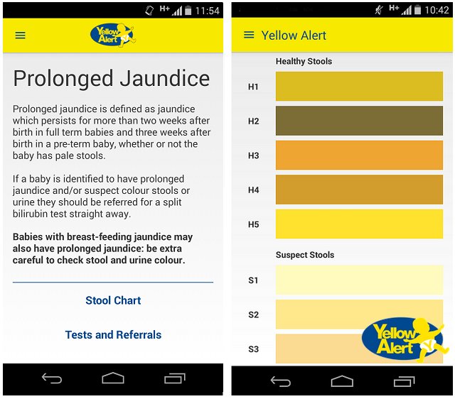 Jaundice Yellow Chart