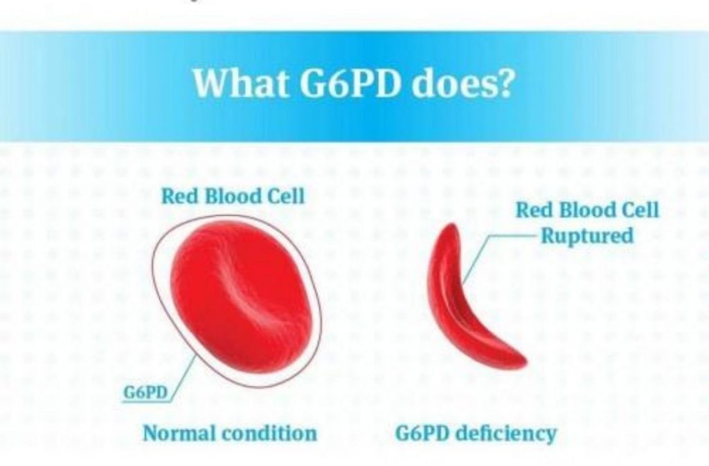 g6pd deficiency foods to avoid