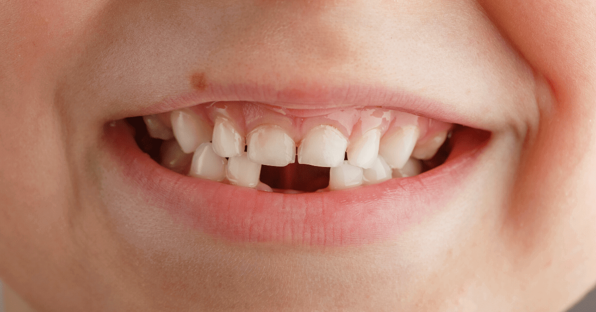 why-do-kids-hate-brushing-their-teeth-change-that-today