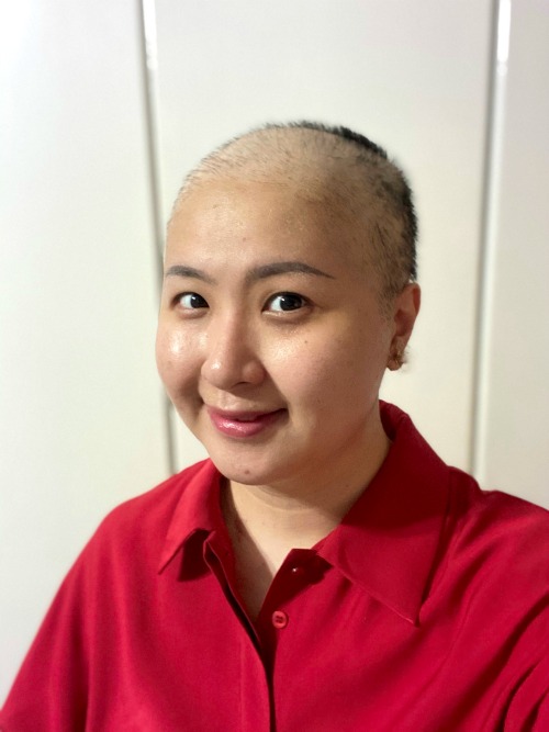 Hair fall started at the third week of the first chemotherapy session