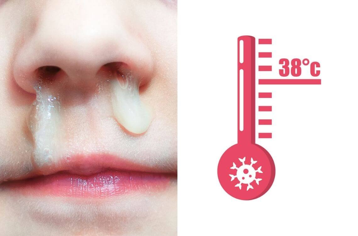 high temperature in common cold