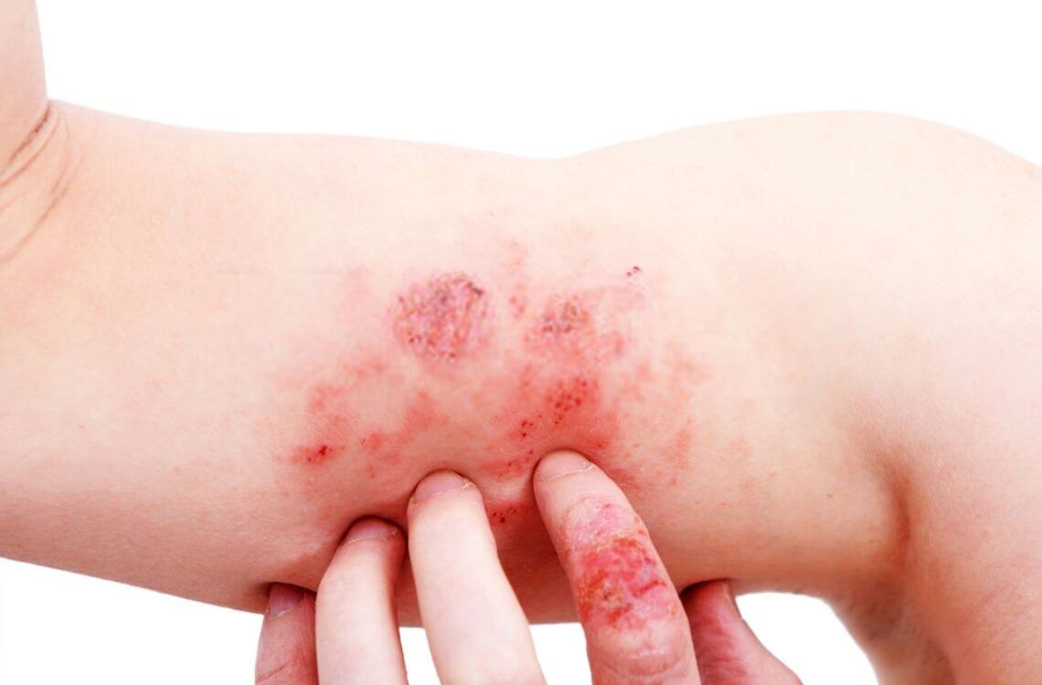 itchiness and rashes are among the childnre's skin conditions