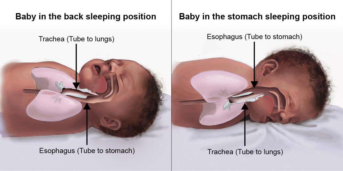 baby's sleeping position to reduce SIDS