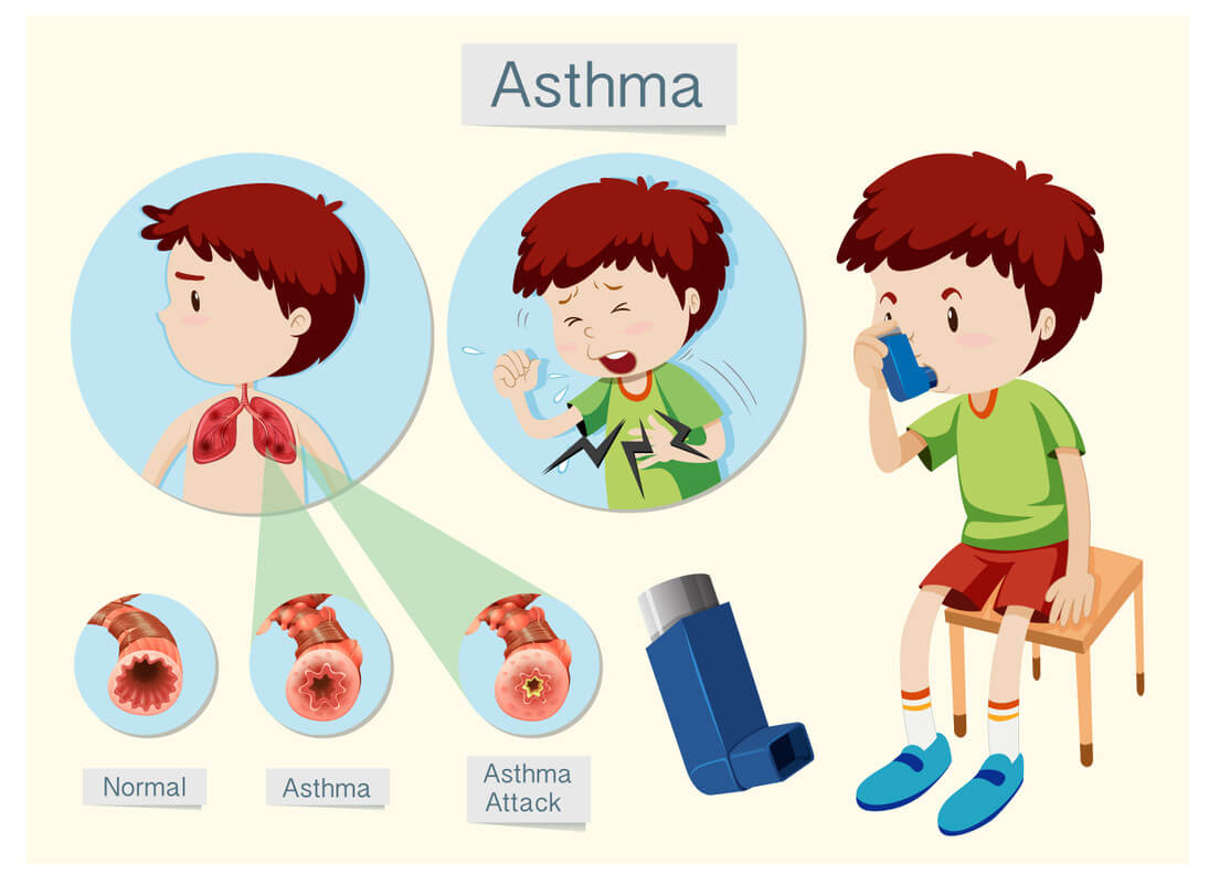 asthma in children