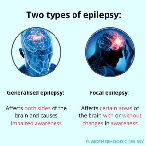 epilepsy-types-motherhood