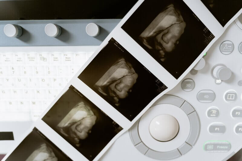 baby-mother-ultrasound-motherhood