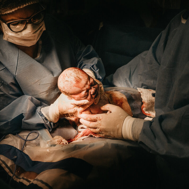 Image of a childbirth