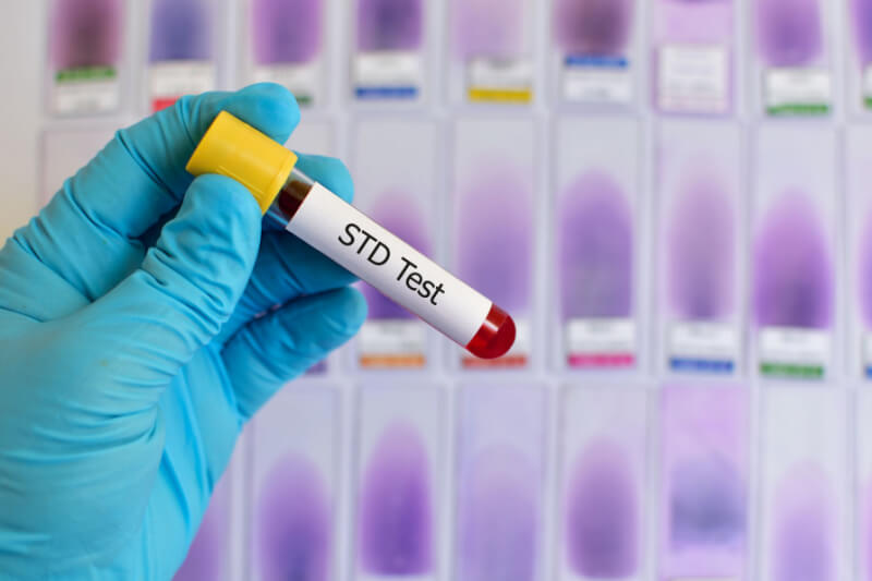 blood-test
