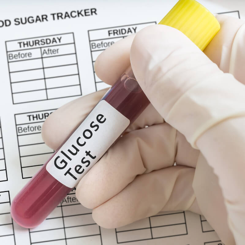 Blood took for glucose test