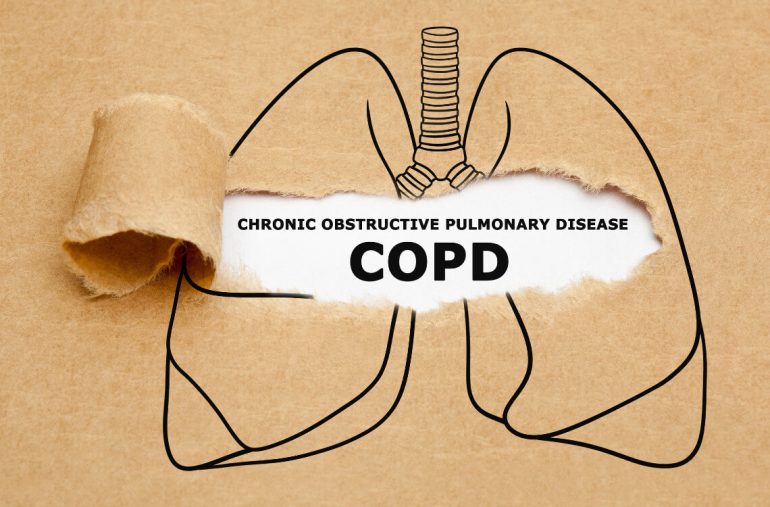 COPD