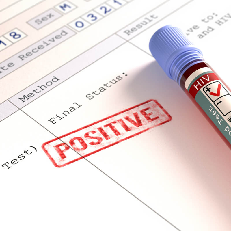 Positive HIV Test