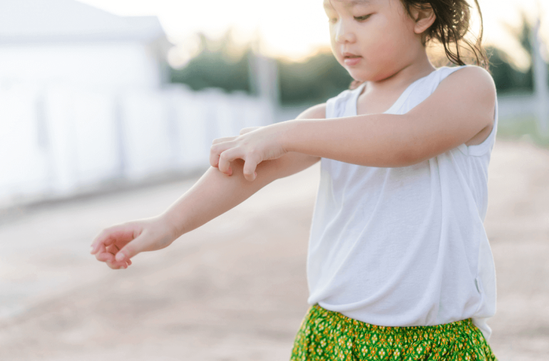 Skin Allergy Children