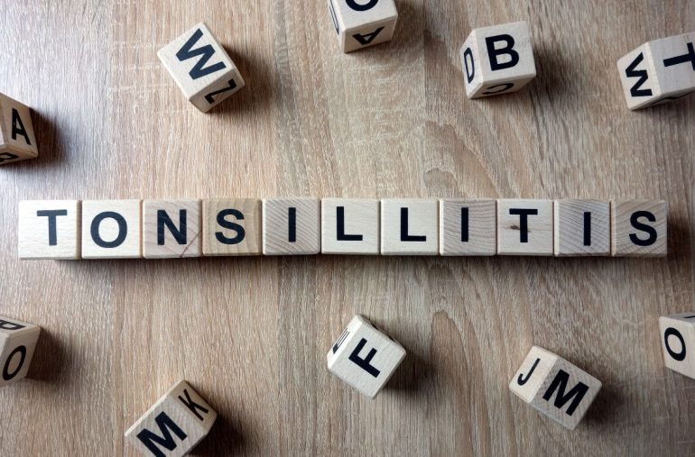 Tonsillitis