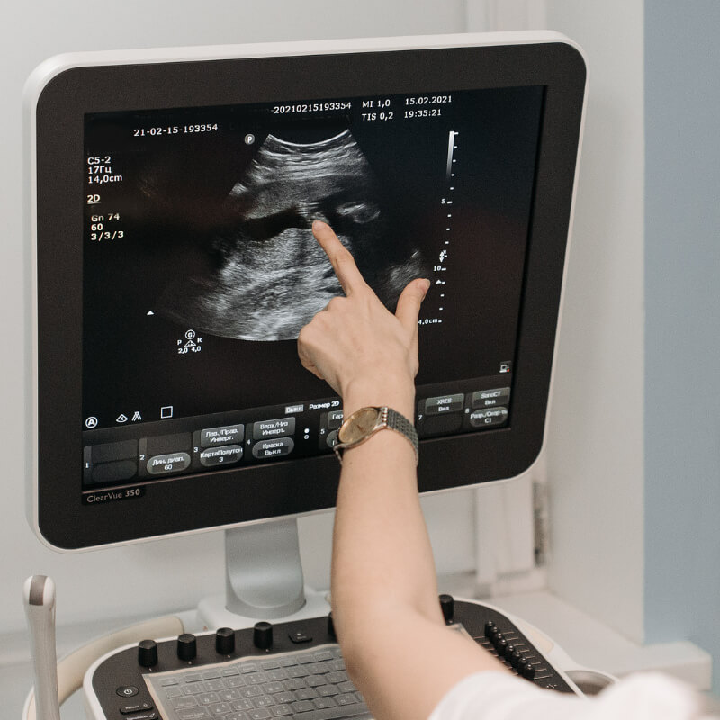 A doctor pointing at screen