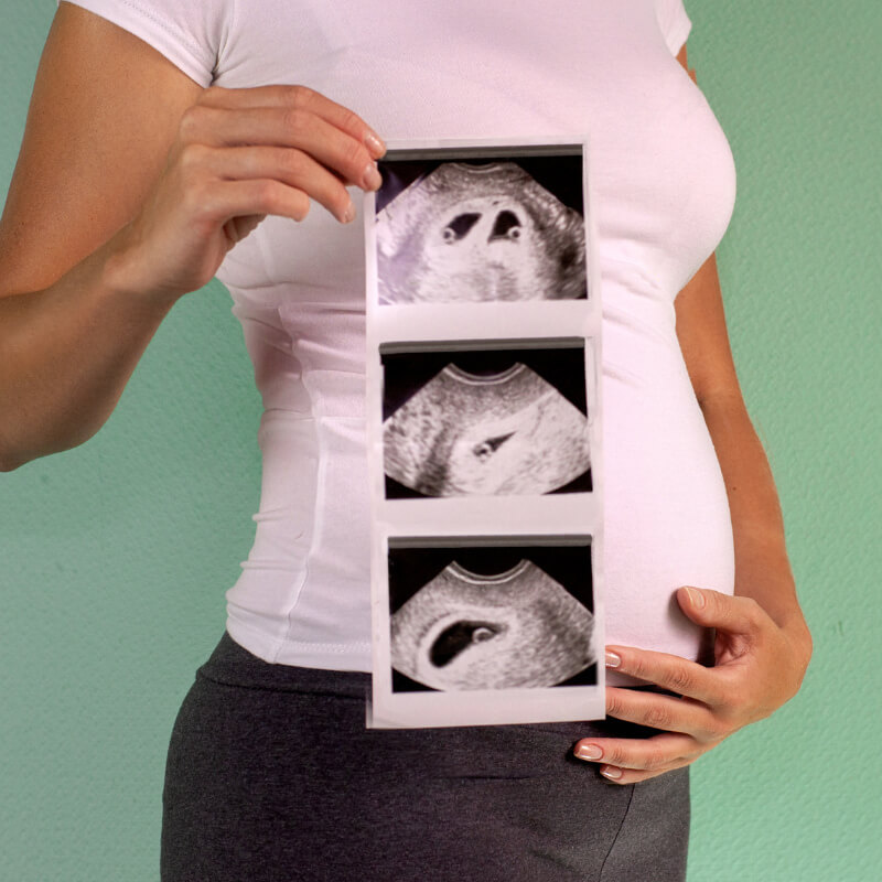 A mum holding scan images