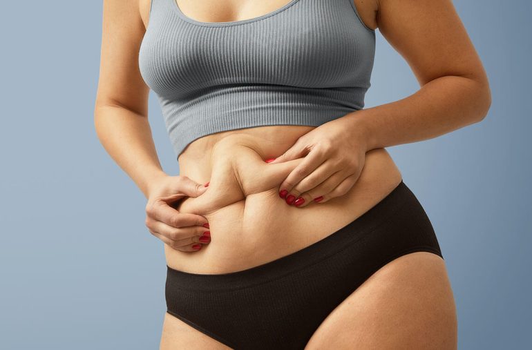 belly-fat