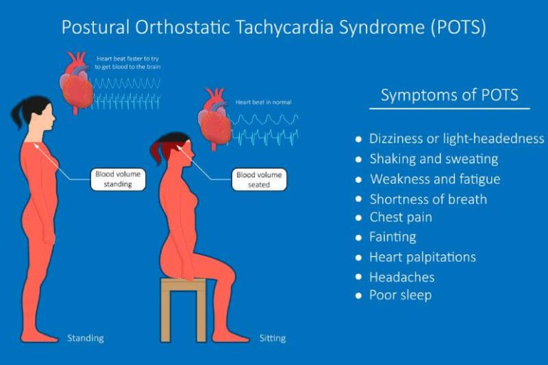 POTS: An Often Misdiagnosed Illness You Should Know About | Motherhood ...