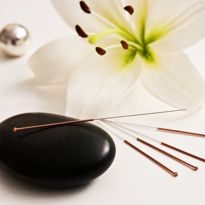 Acupuncture Safety