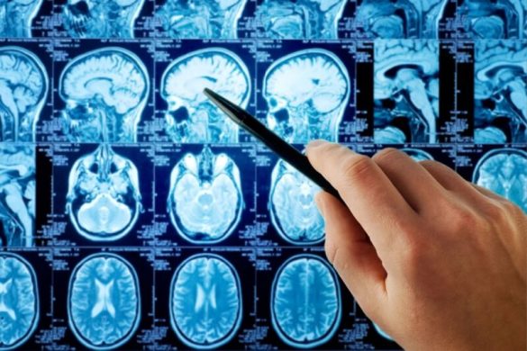 How Pregnancy Changes a Woman’s Brain - June 2026 | Motherhood Malaysia