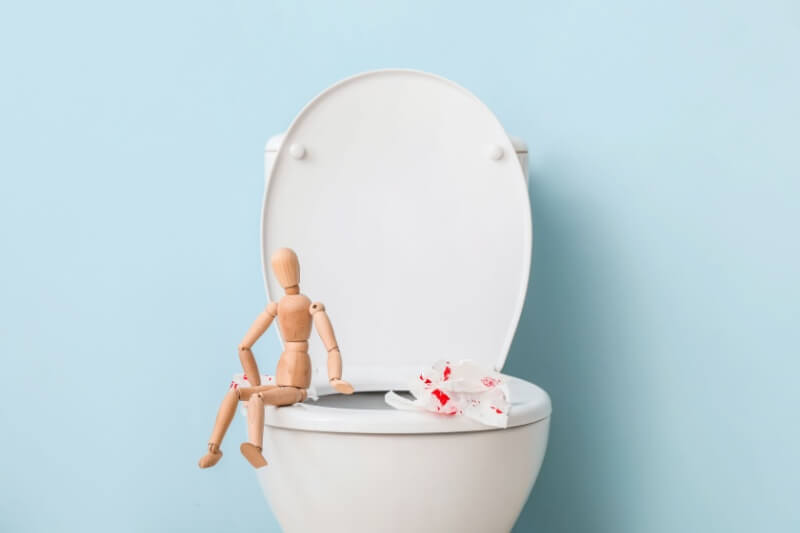 haemorrhoids2