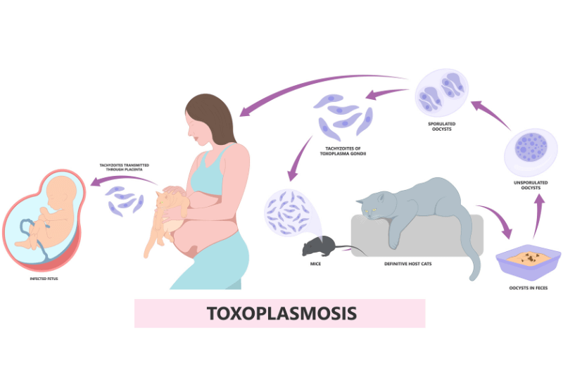 toxoplasmosis