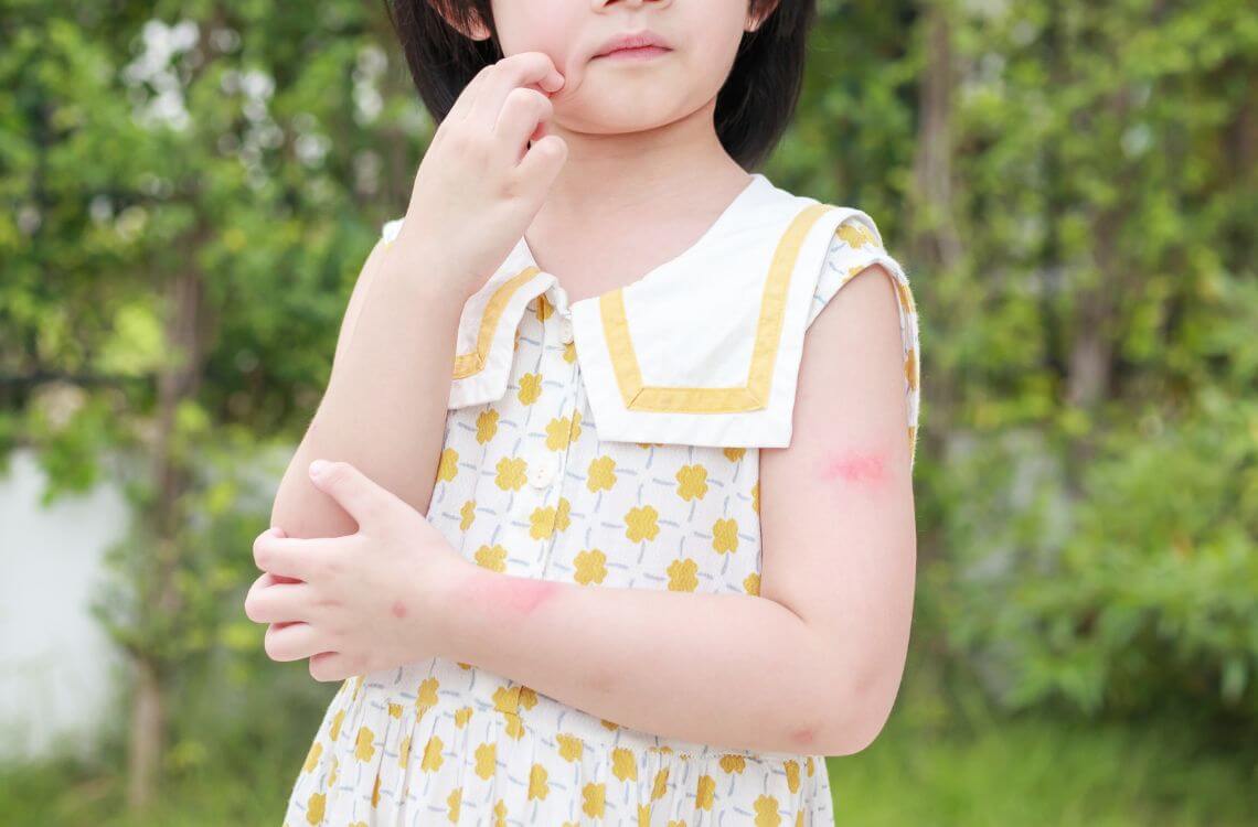 Young girl itchy skin