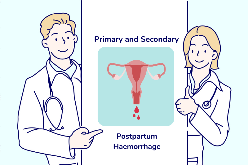 postpartum haemorrhage