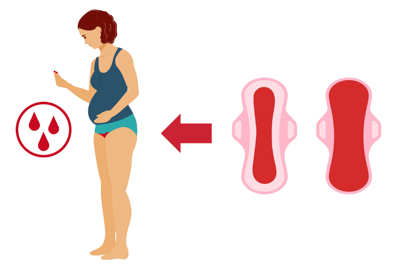 heavy bleeding postpartum haemorrhage