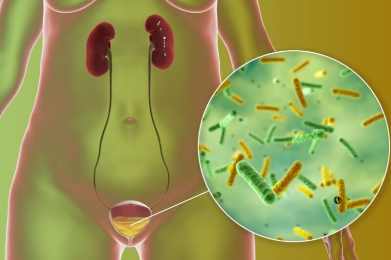 How to Manage Urinary Tract Infections in Children - October 2026 ...