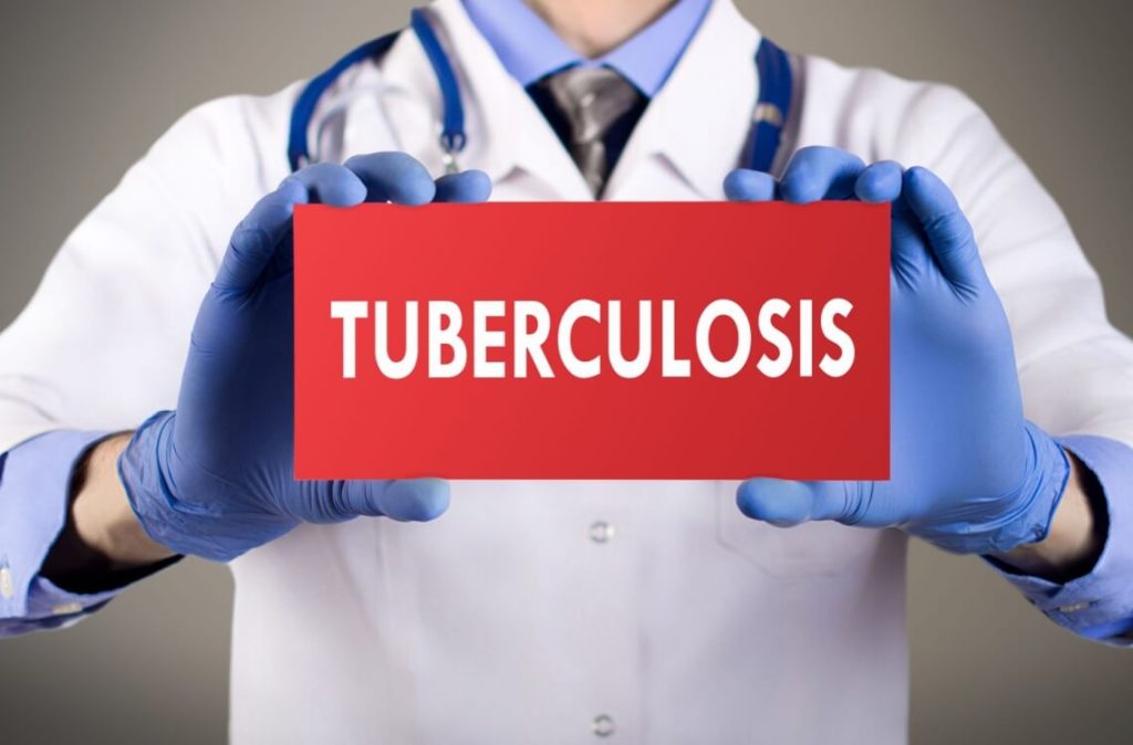 tuberculosis