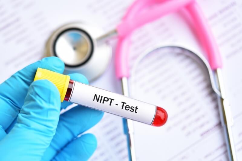 NIPT test screening tube