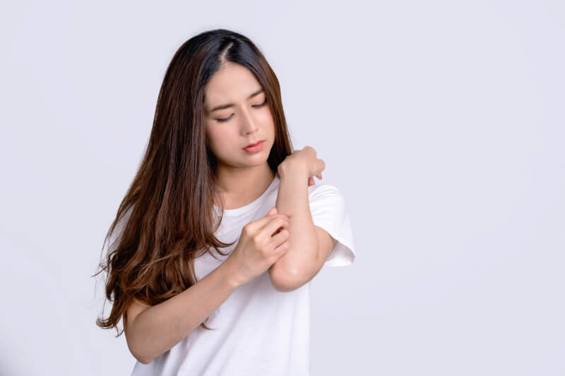 woman scratching elbow 