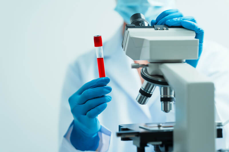 blood-test