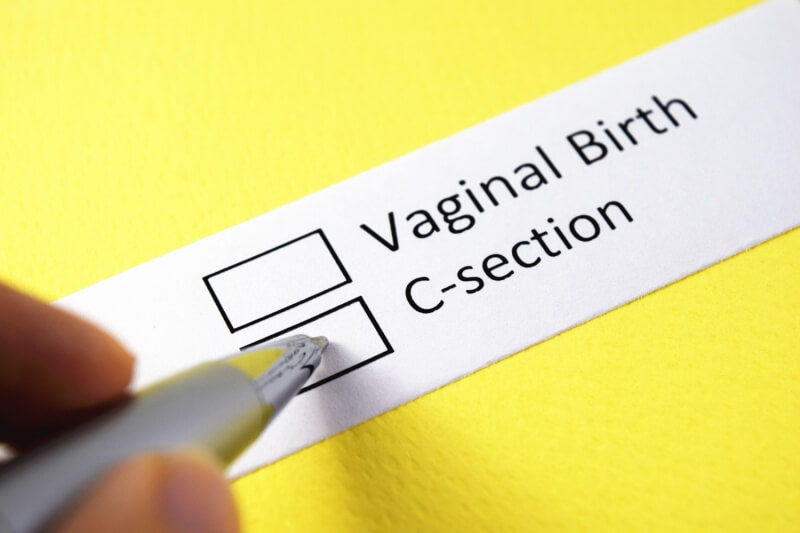 delivery slips vaginal birth or c-section