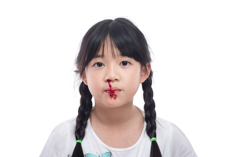 blood-nose