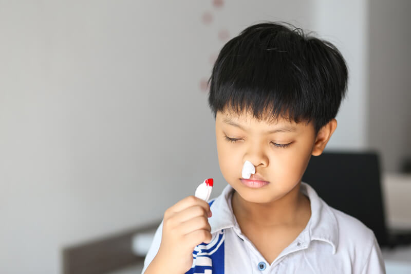nosebleed