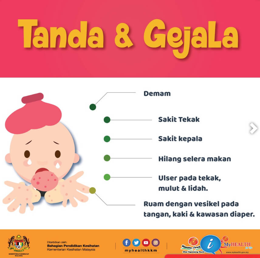 tanda dan gejala HFMD