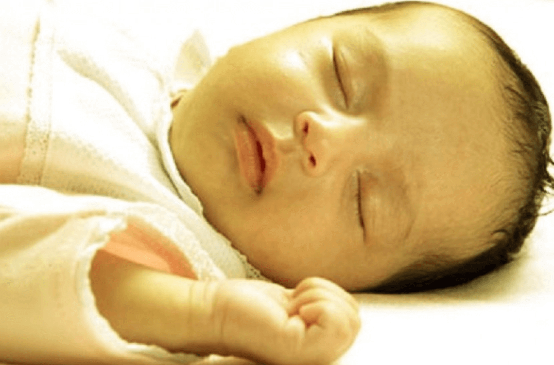 Желтушка у новорожденных дома. Гемолитическая желтуха новорожденных. Гипербилирубинемия желтуха новорожденных. Транзиторная желтуха новорожденных. Неонатальная желтушка у новорожденного.
